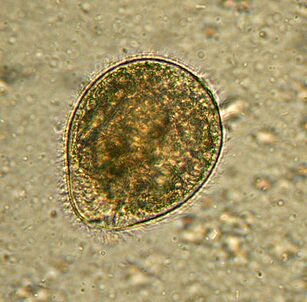 A Balantidium a legnagyobb protozoon parazita