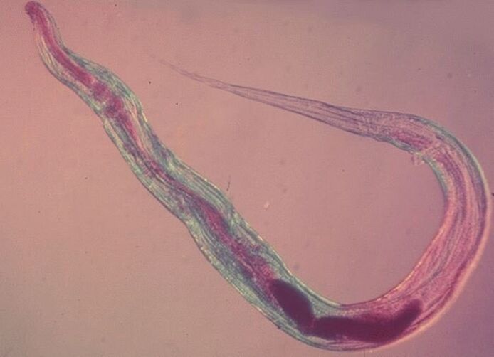 Pinworm a mikroszkóp alatt